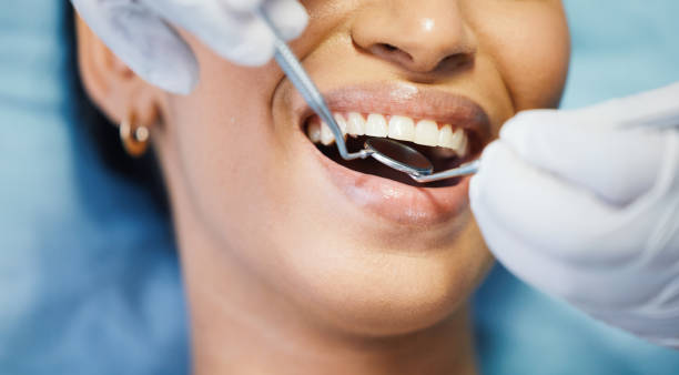 Best Emergency Wisdom Teeth Removal in Springdale, NC