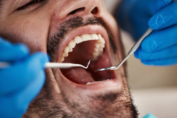 Best Emergency TMJ Treatment in Springdale, NC