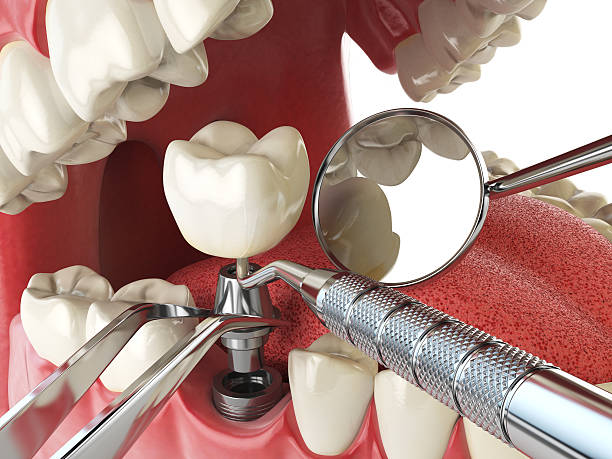 Best Emergency Gum Treatment in Springdale, NC